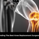 Knee Replacement Surgeon In Town